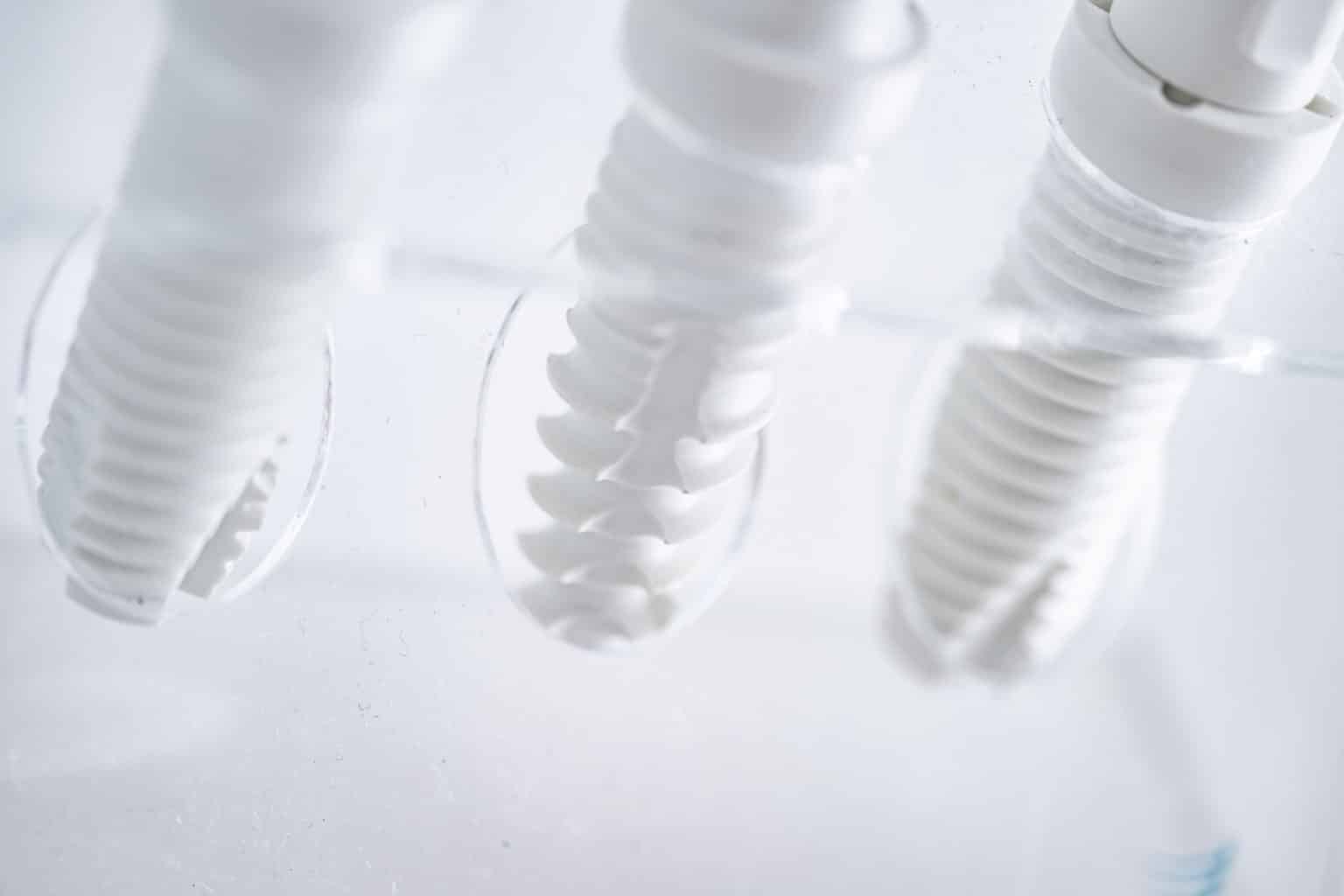 Keramikimplantat in Augsburg Implantate aus Keramik