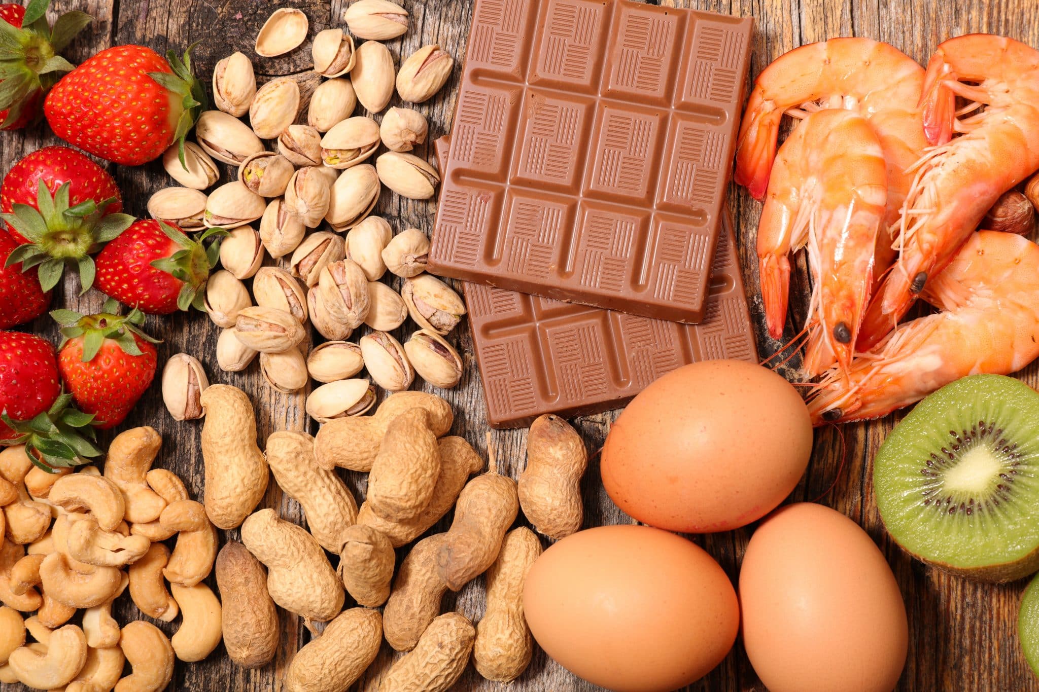Lebensmittel wie Erdbeeren, Nüsse, Schokolade, Garnelen, Eier und Kiwi