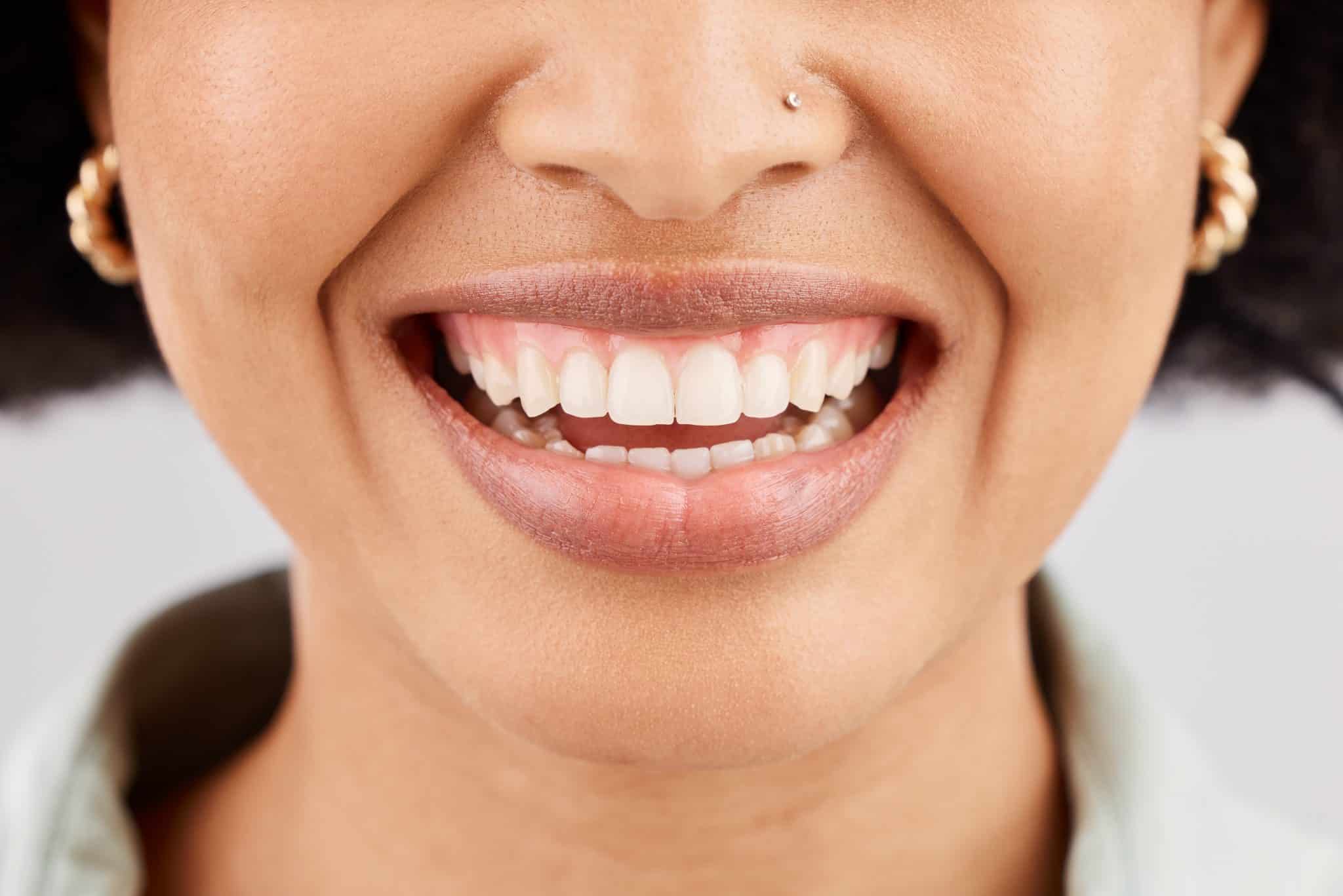 Das Bild zeigt Nase und Mund einer jungen Frau mit strahlendem Lächeln und gesundem Zahnfleich.