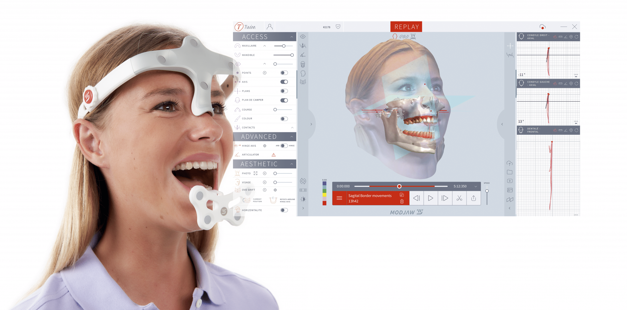 Das Foto zeigt eine junge Patientin beim ModJaw-Funktions- und Face-Scan mit Echzeitaufzeichnung.